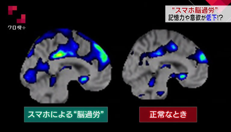 研究によると、脳はこれまで考えられていたよりも10倍多くの情報を保存できる